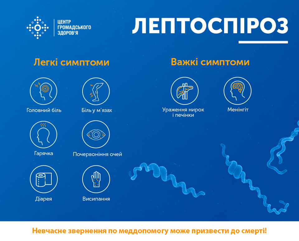 Врачи рассказали, как избежать смертельного заболевания лептоспироз, которое передается от крыс